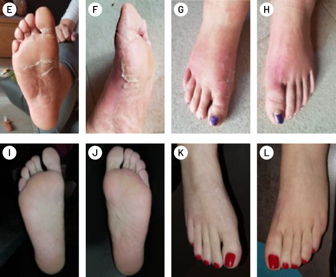 testimonials-psoriasis_case_3-all-(2).jpg