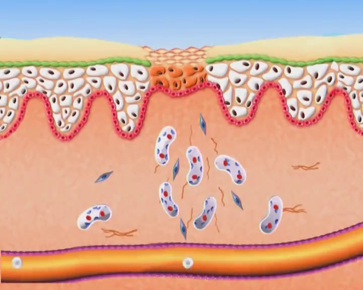 Video Poster - BIOPTRON<span style=